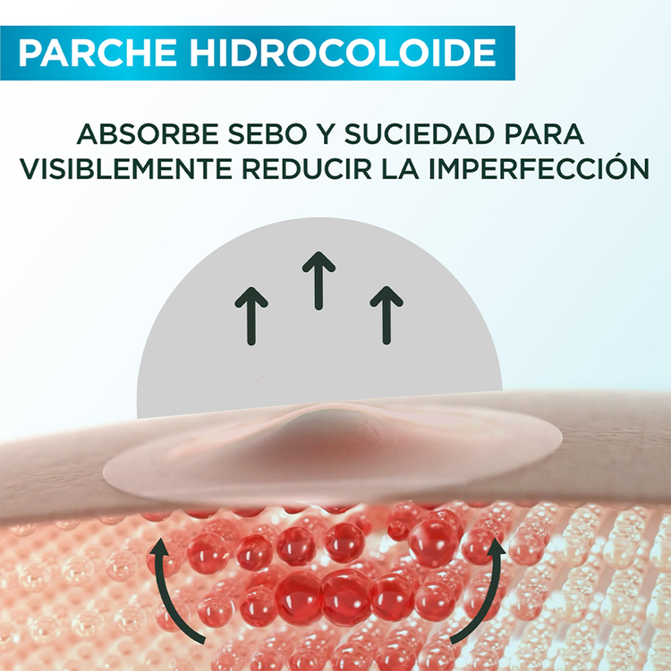 Pimple Patches - Parches hidrocoloides, para acné