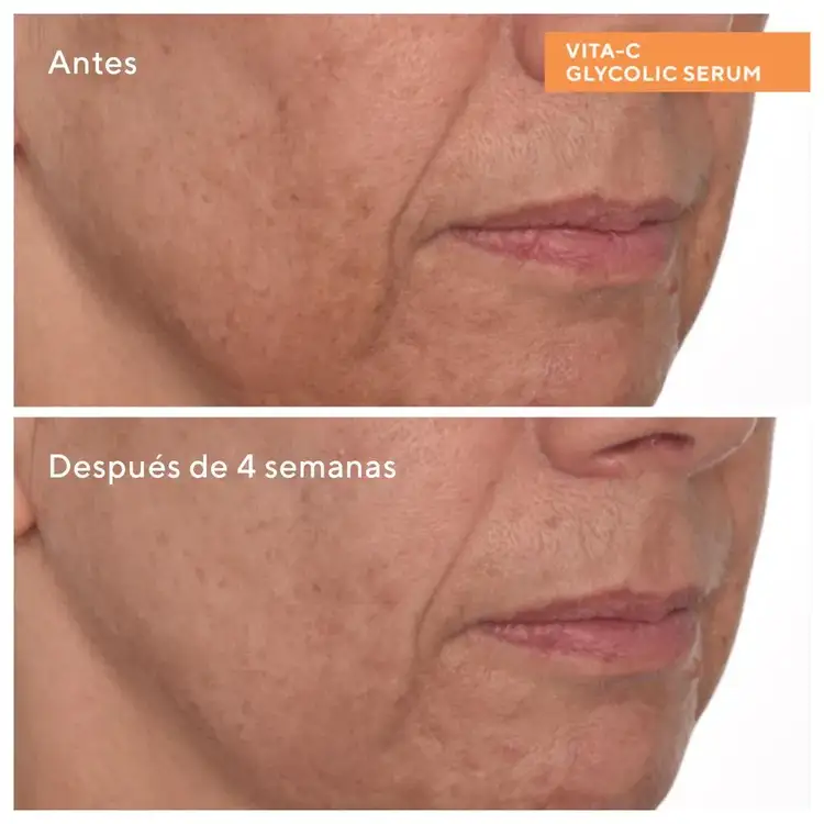 Antimanchas - Vita -C Brightening Serum Suero piel luminosa