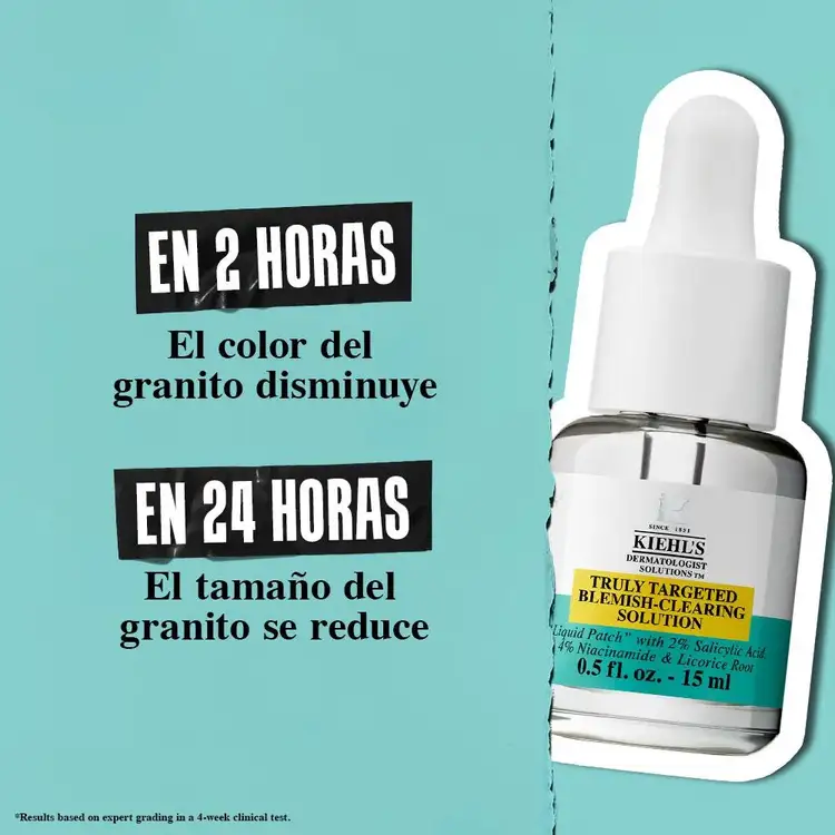 Acne Suero elimina imperfecciones por acné y descaneve marcas