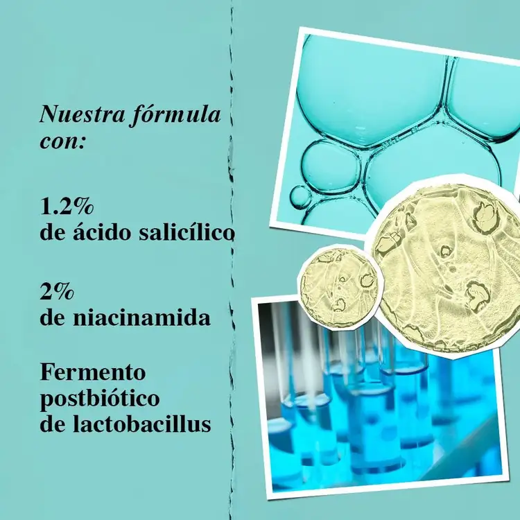 Acne Loción hidratante para acné con ácido salicílico al 1.2%