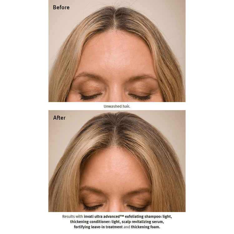 Invati Ultra Acondicionador ligero evita la caida del cabello y engrosa la fibra capilar
