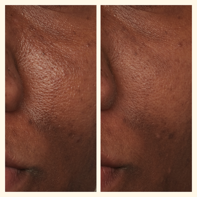 Potato Peel - Crema facial, cuidado natural para revitalizar y renovar la piel