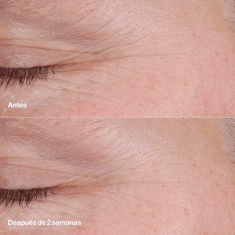 Smart Clinical Repair Retinoid - Bálsamo anti-envejecimiento, suaviza y rellena líneas finas