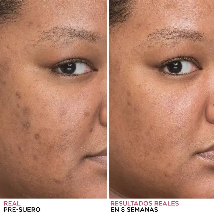 Bye Bye Serum Suero facial apto para todo tipo de pieles