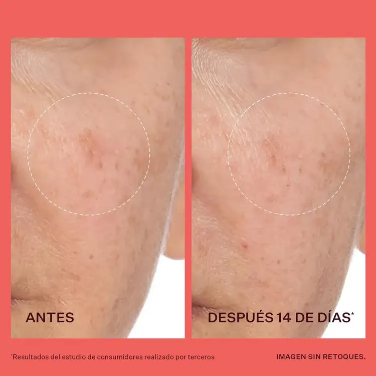 Transparen-C Pro Brightening Moisturizer Hidratante unifica el tono de piel