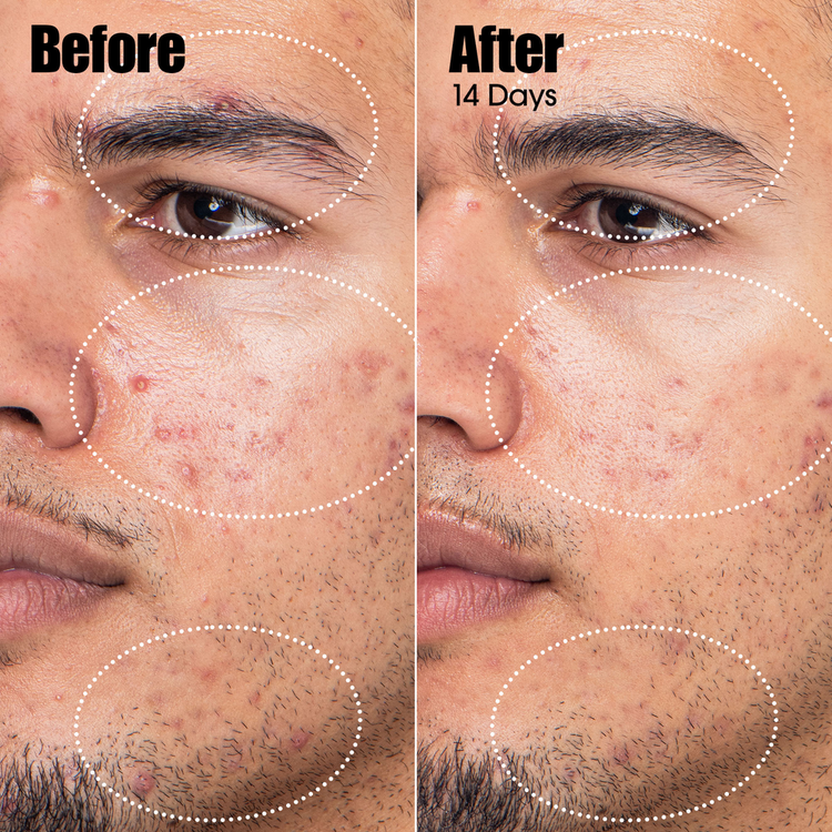 Peace Keeper Treatment Suero calma la piel irritada