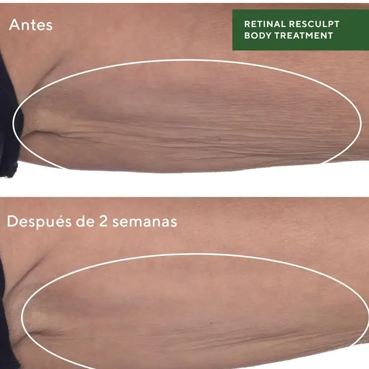 Retinal Resculpt Body Treatment - Tratamiento corporal, redefine, reafirma y alisa la piel