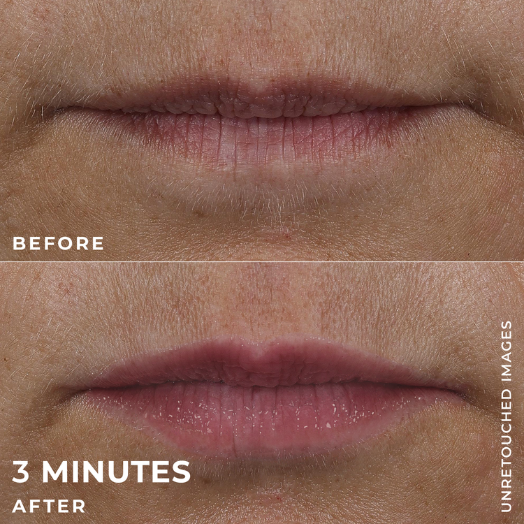 Derm Correxion Voluminizador de labios voluminiza los labios