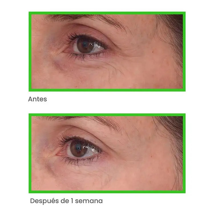 Retinal Resculpt Eye Treatment Tratamiento antiedad reduce líneas y arrugas profundas
