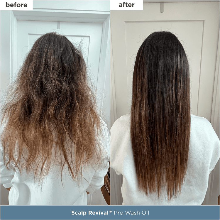 Scalp Revival Set humectante reduce el cuero cabelludo seco