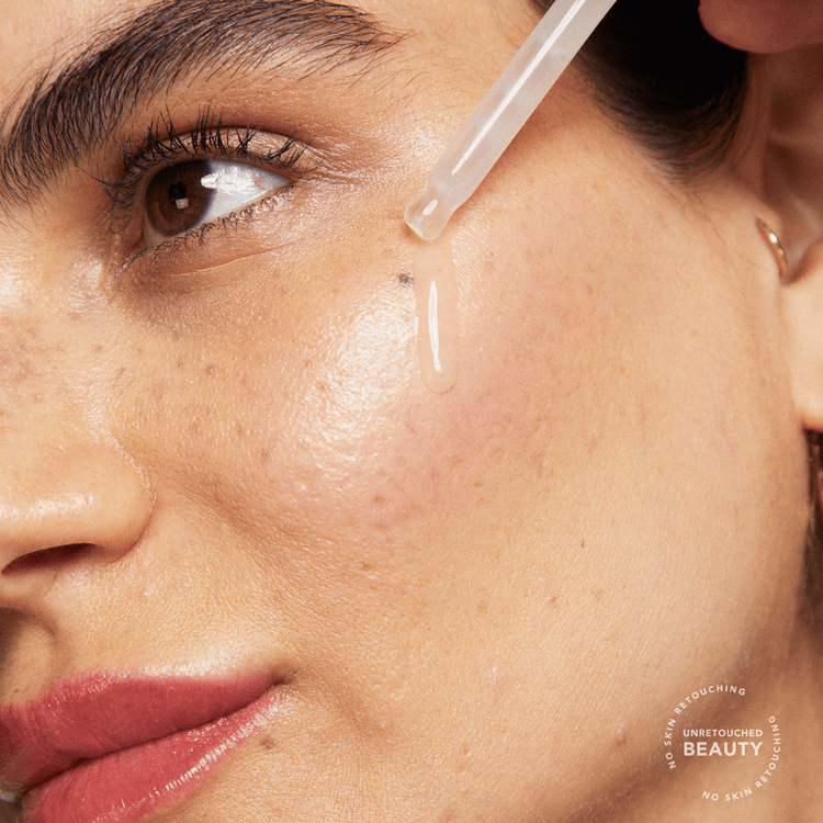 Dark Spot Serum 7% Pro-Niacinamide Suero combate el acné