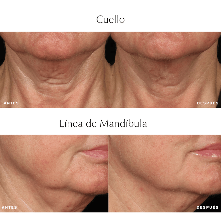 Perfectionist Pro Rapid Firm + Lift Suero con hexapéptidos