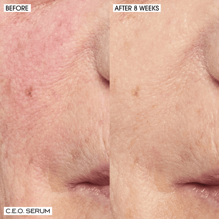 CEO Home + Away - Set de regalo, Serum Vitamin C 30 ml + mini