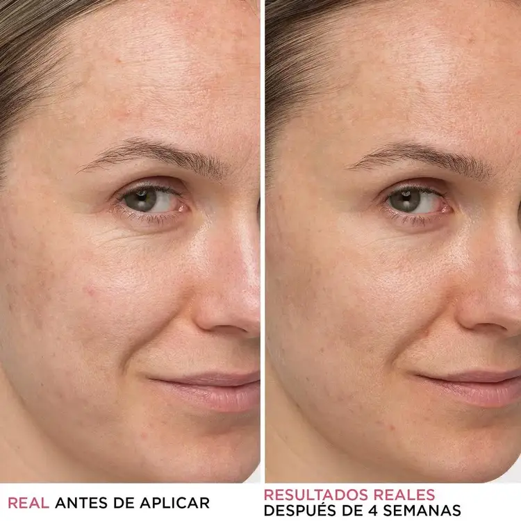 Confidence In A Cream - Crema facial, minimiza visiblemente los poros