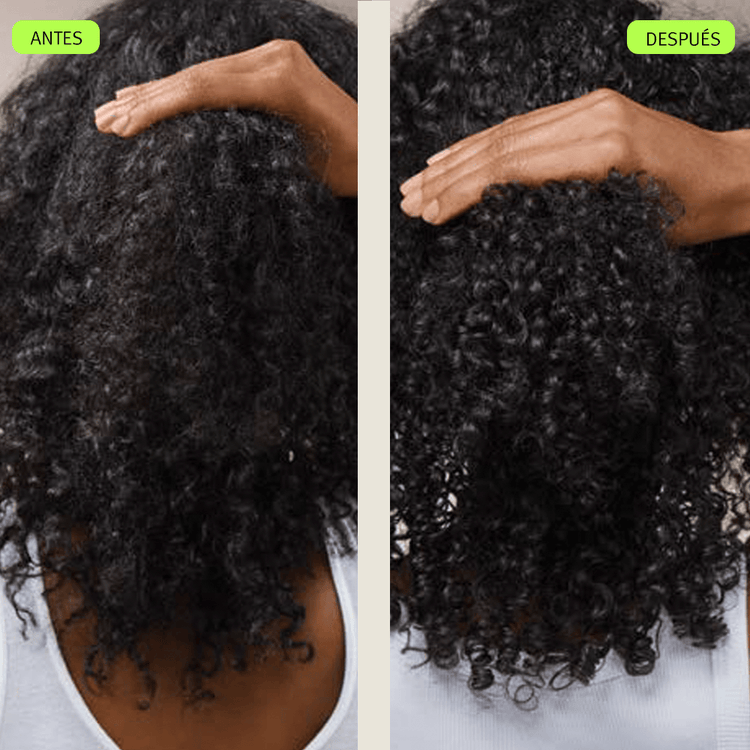 Scalp Solutions Set de regalo engrosamiento y volumen